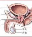 男性患前列腺炎的原因是什么